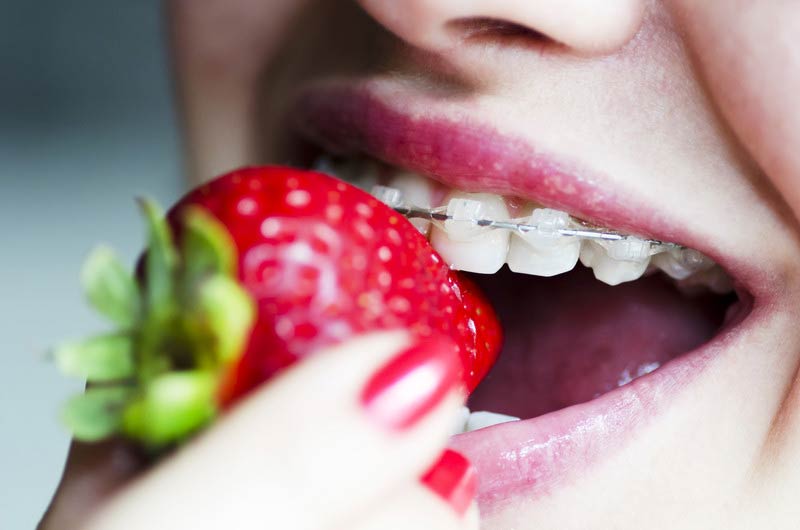 Nutrition during orthodontics