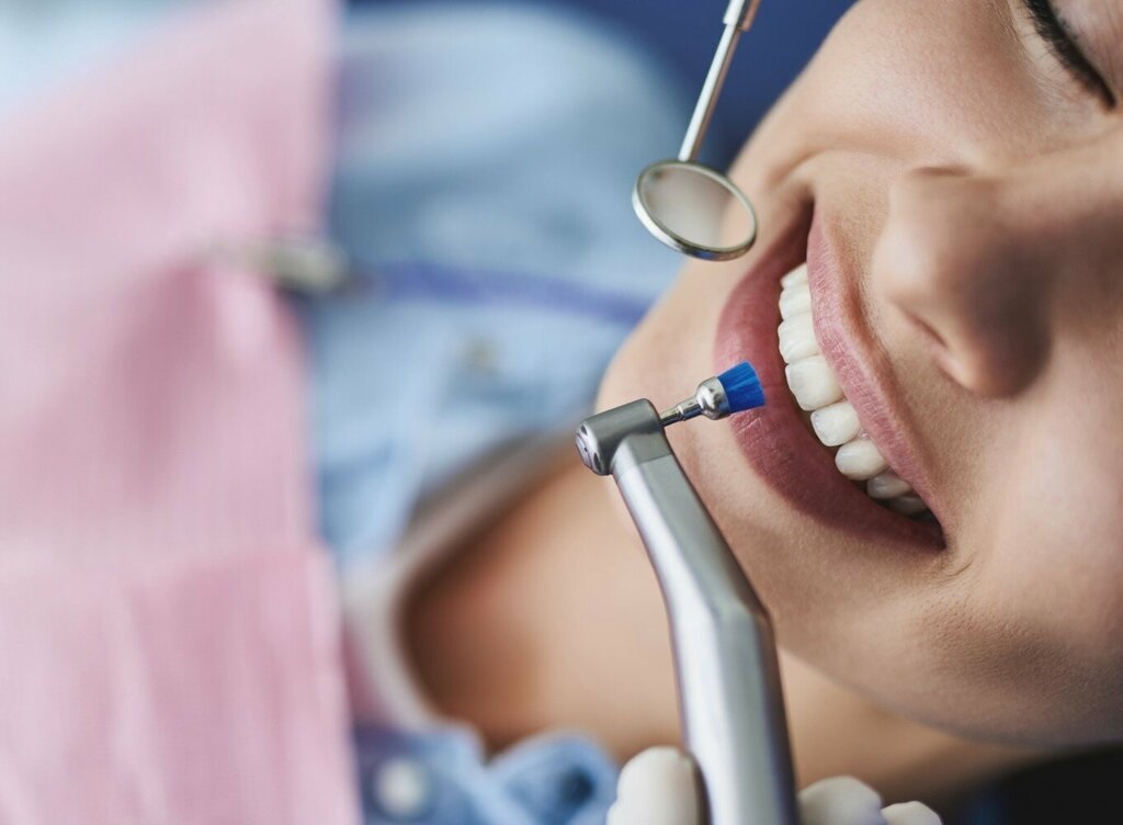 Professional Teeth Cleaning vs At-Home Cleaning Methods