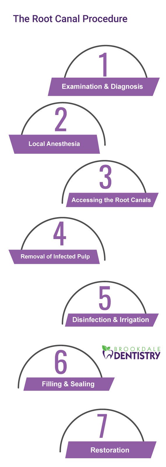 Root_Canal_infographic_BD